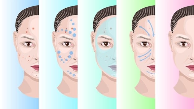 A visual guide differentiating between ice pick, boxcar, and rolling acne scars with illustrative diagrams.